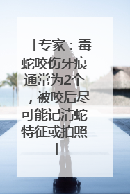 专家：毒蛇咬伤牙痕通常为2个，被咬后尽可能记清蛇特征或拍照