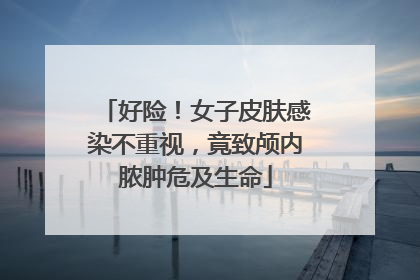 好险！女子皮肤感染不重视，竟致颅内脓肿危及生命